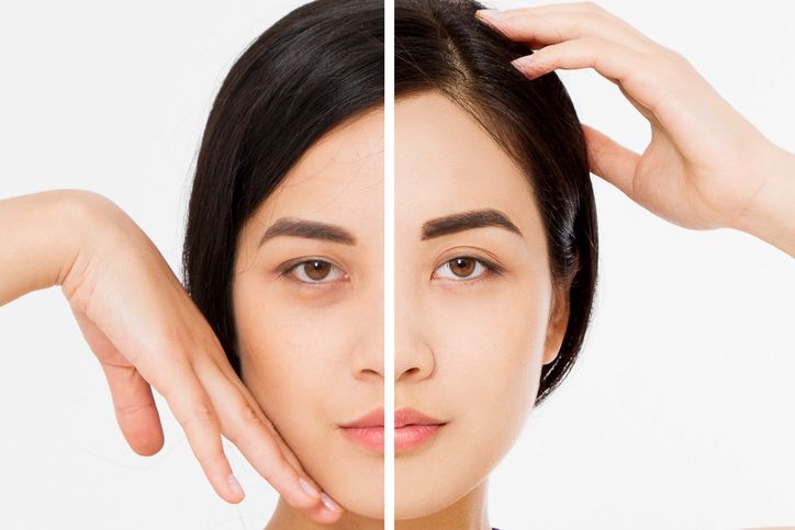 Banish Dark Circles: Causes, Prevention, and THEE Eye Cream Solution